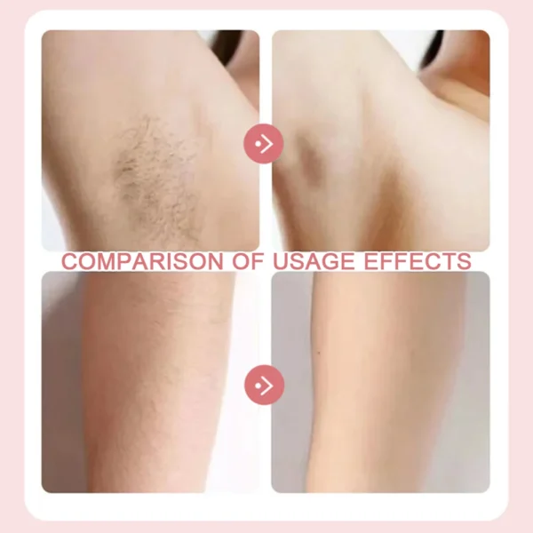 hair body removal